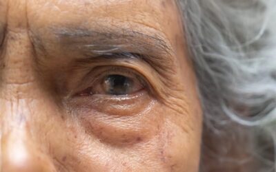 Cataracte : quels sont les symptômes ?