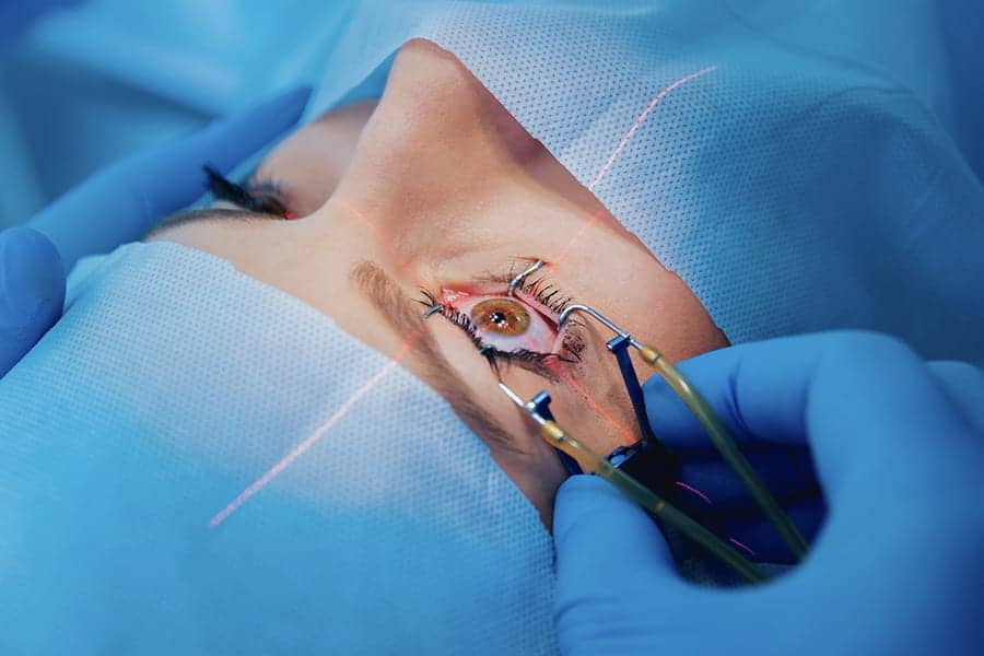 chirurgie refractive oeil c est quoi docteur maxime delbarre chirurgien ophtalmologiste specialiste montpellier chirurgie refractive oeil c est quoi docteur maxime delbarre chirurgien ophtalmologiste specialiste montpellier
